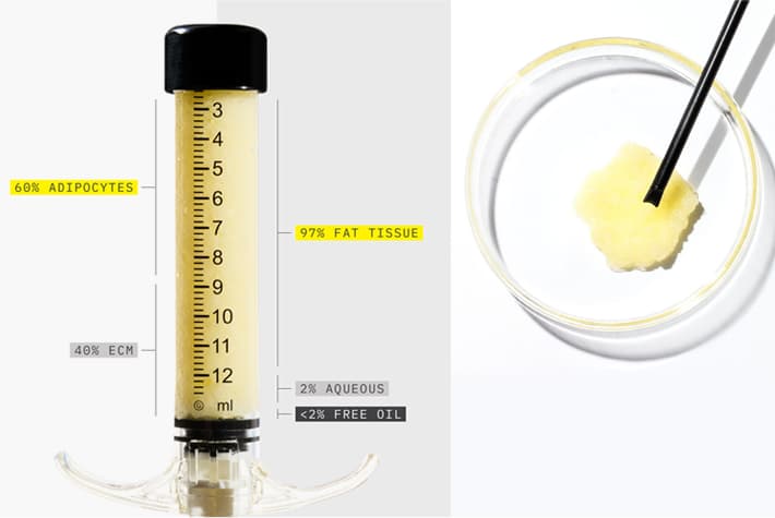 alloClae product composition: 60% adipocytes, 40% ECM, 97% fat tissue, less than 2% free oil