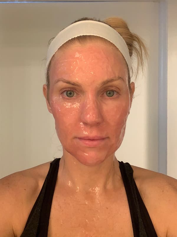 Patient wearing CO2 Lift Pro carboxy treatment mask