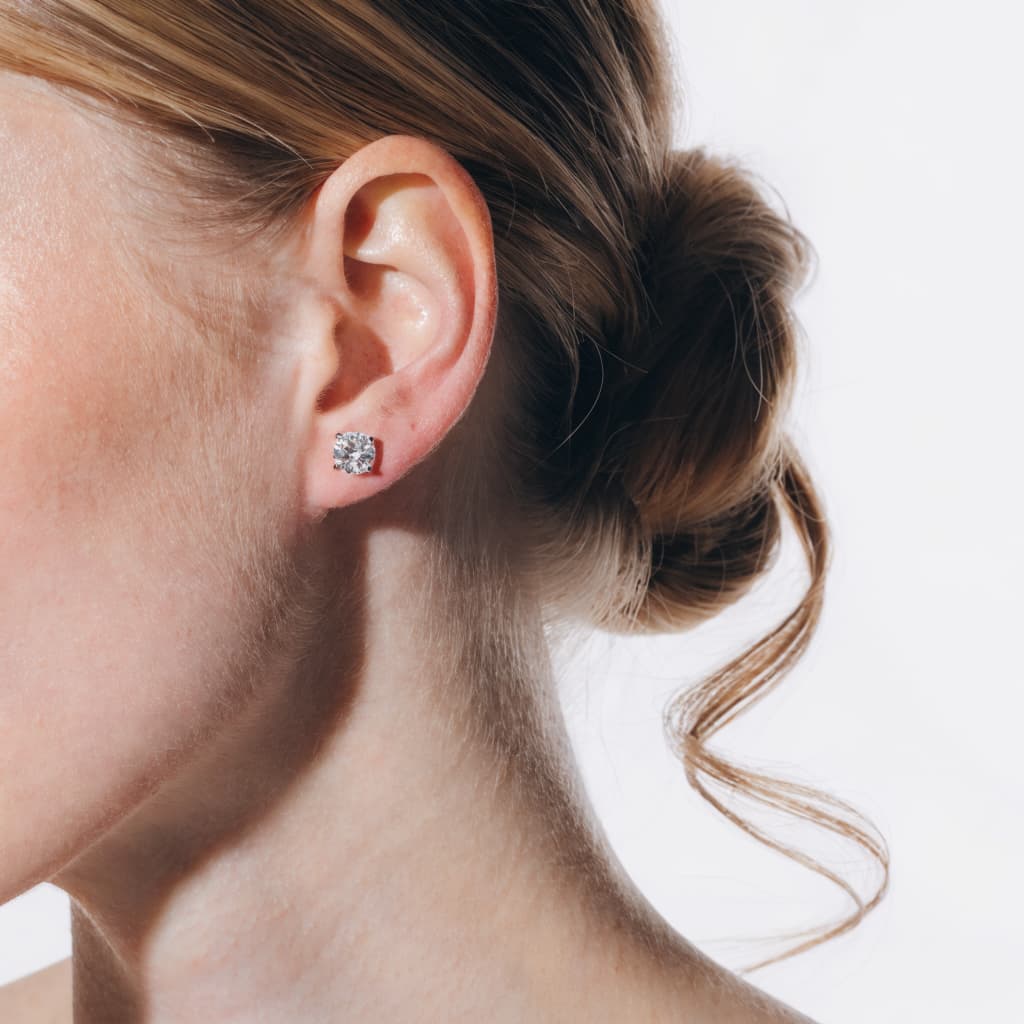 Ear Keloid Removal before and after gallery