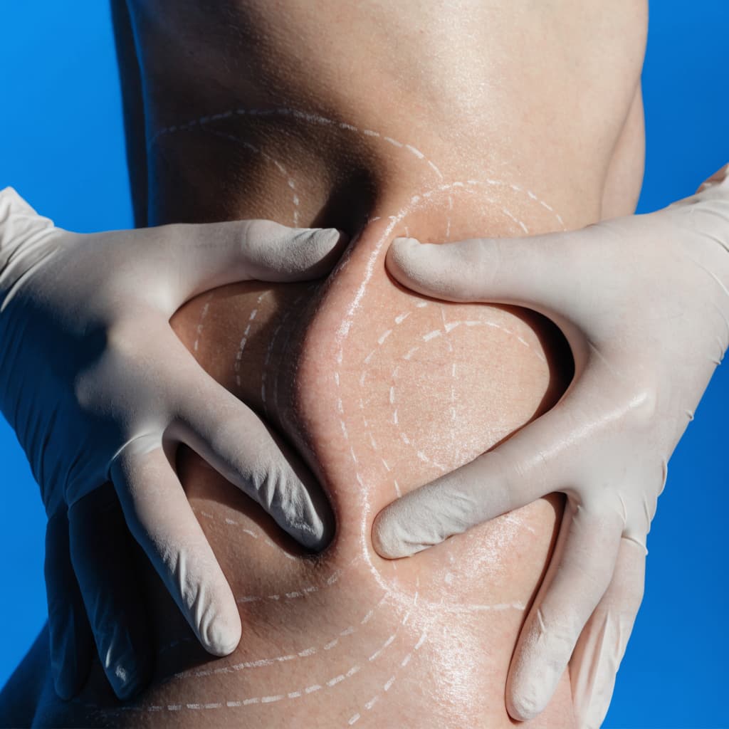 Can a Chin Implant Improve My Jawline?