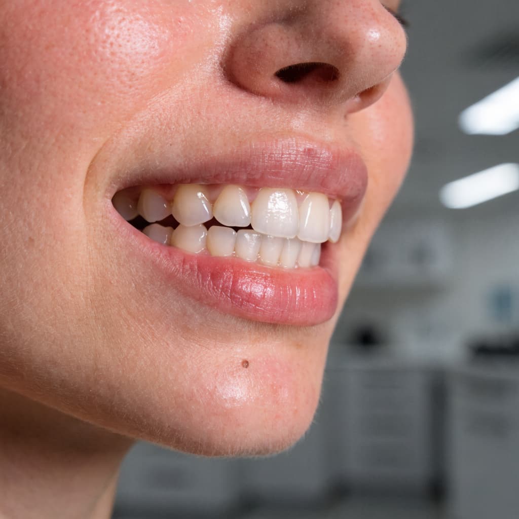 smile restoration: how oral and maxillofacial surgery can improve your quality of life