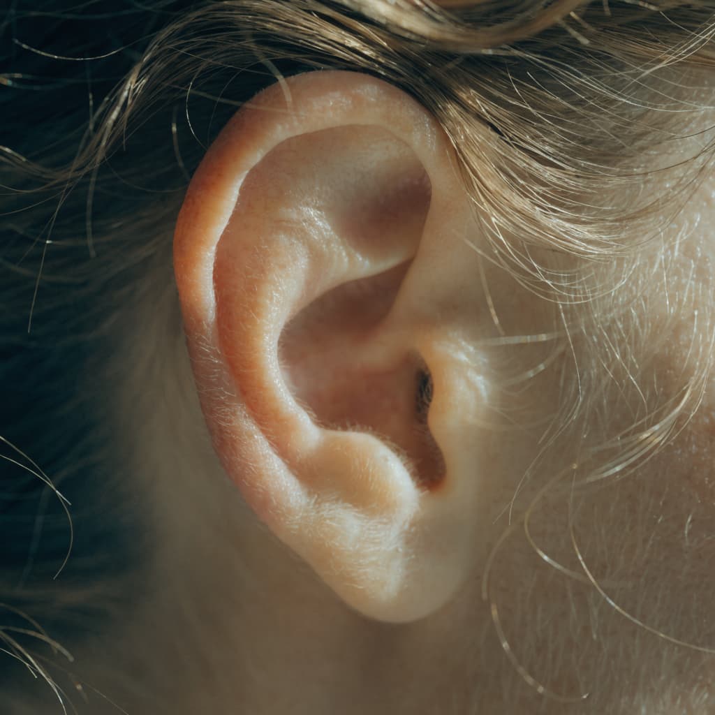 Earlobe Reduction before and after gallery