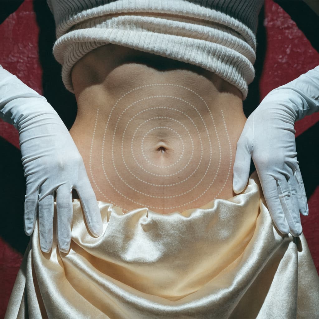 Tummy Tuck before and after gallery